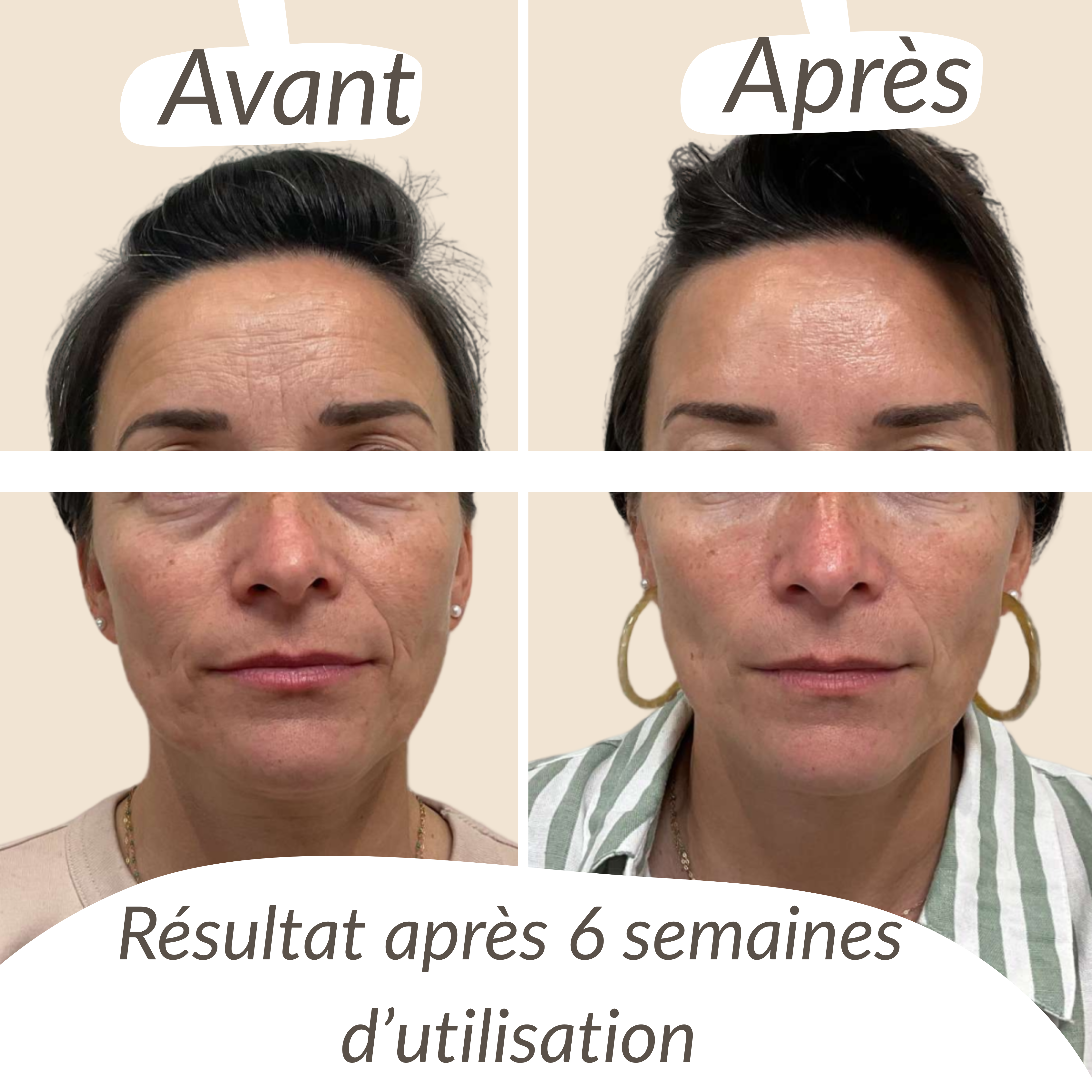 CosMyd - Masque Au Collagène (4 Masques)