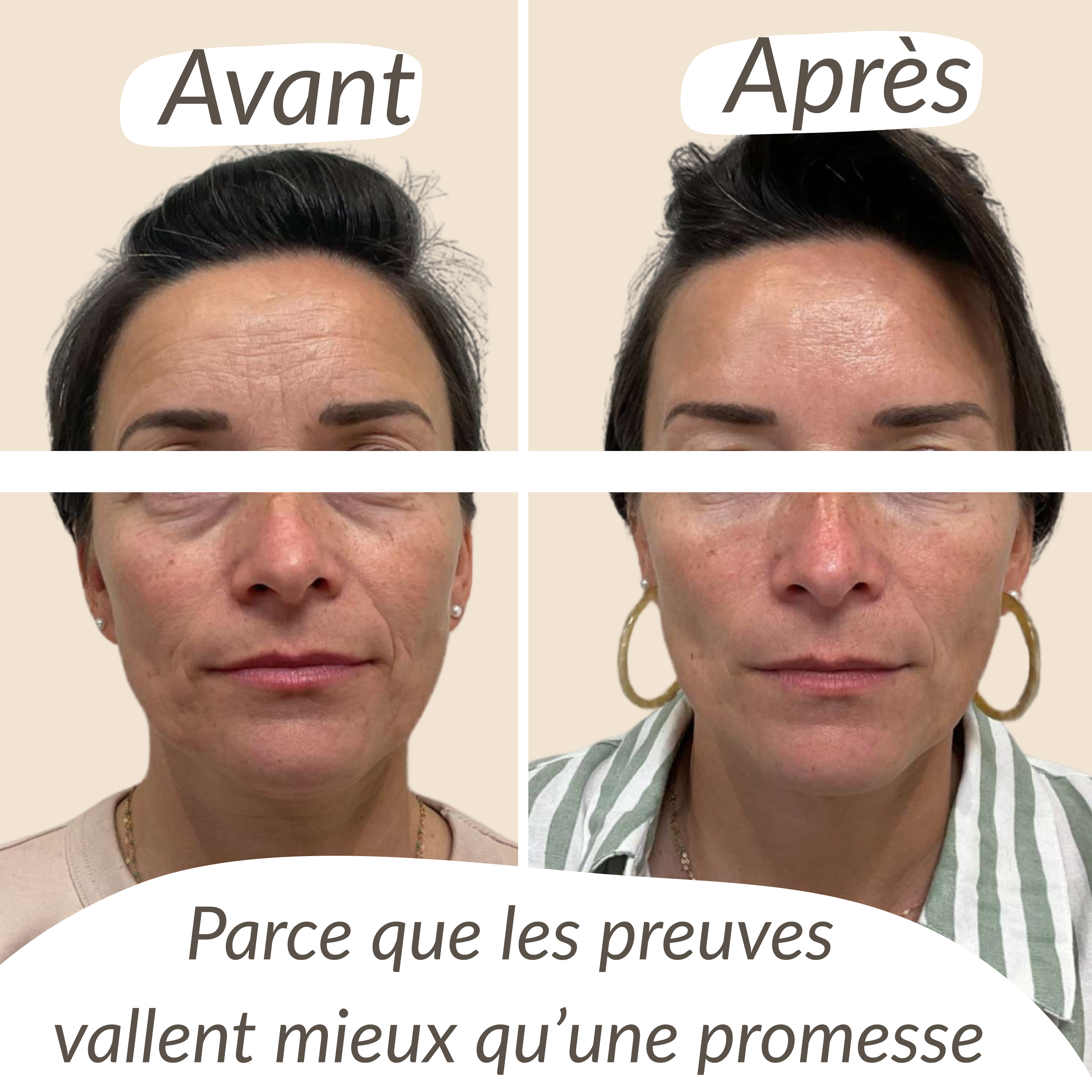 Masque Collagène CosMyd